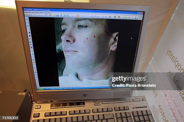 Suspect in the JonBenet Ramsey murder case John Mark Karr is displayed on a computer screen at the Siam Swan Cosmetic Clinic, from when he was a...