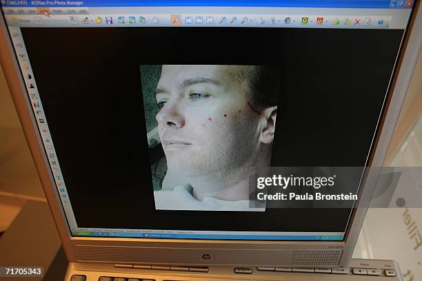 Suspect in the JonBenet Ramsey murder case John Mark Karr is displayed on a computer screen at the Siam Swan Cosmetic Clinic, from when he was a...