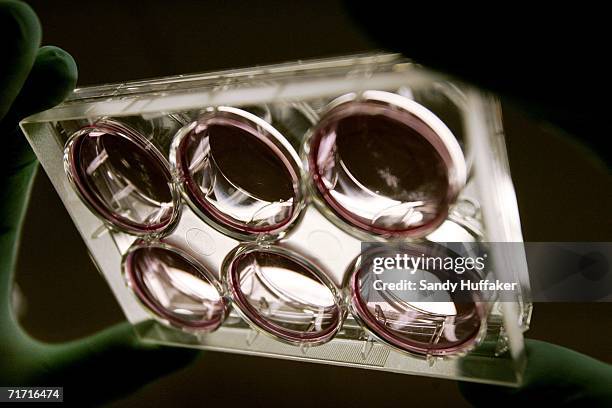 Stem cell cultures are held up in a lab at the Reeve-Irvine Research Center at the University of California Irvine August 25, 2006 in Irvine,...
