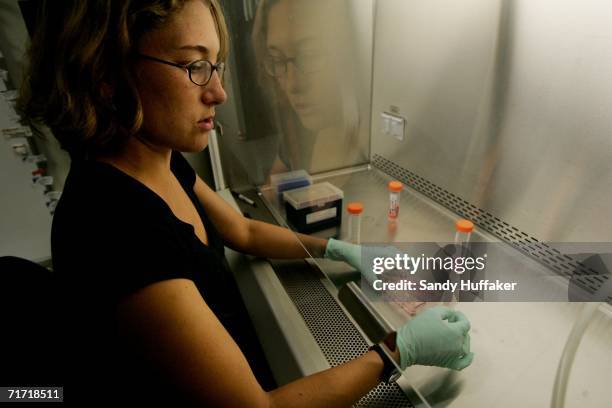 Graduate student Michelle Wedemeyer works with stem cell cultures in a lab at the Reeve-Irvine Research Center at the University of California Irvine...