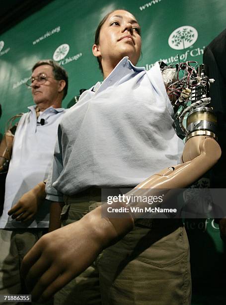 Claudia Mitchell demonstrates the functionality of her "bionic arm" during a news conference September 14, 2006 in Washington, DC. Mitchell is the...