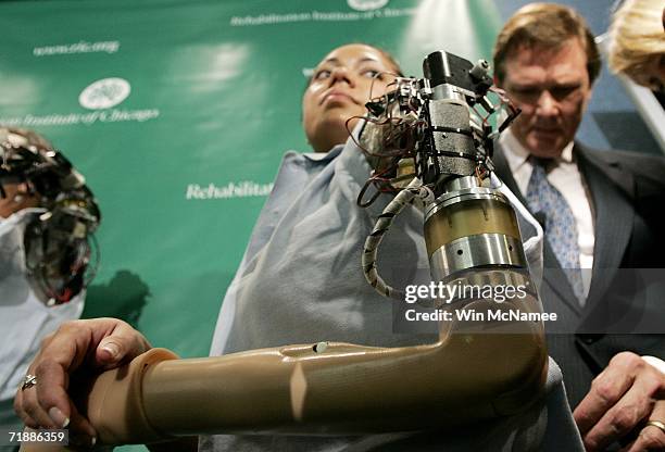 Claudia Mitchell demonstrates the functionality of her "bionic arm" during a news conference while the arm's developer Dr. Todd Kuiken observes on...