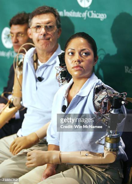 Claudia Mitchell and Jesse Sullivan take part in a news conference on September 14, 2006 in Washington, DC highlighting the development of "bionic...