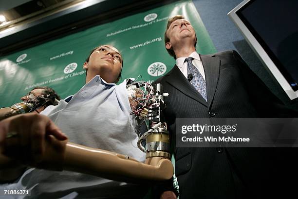 Claudia Mitchell demonstrates the functionality of her "bionic arm" during a news conference while the arm's developer Dr. Todd Kuiken observes on...