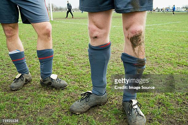 legs of footballers - soccer injury stock-fotos und bilder