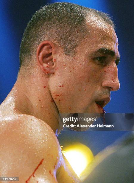Worst Boxing Injuries 75 Boxer Fracture Stock Photos, High-Res Pictures, and Images - Getty ...