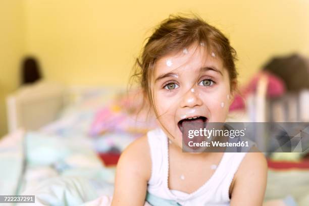 portrait of girl with chickenpox at home - varicela fotografías e imágenes de stock