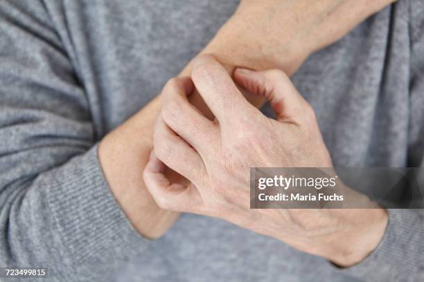 senior woman scratching arm, close-up - irritation skin woman stock pictures, royalty-free photos & images