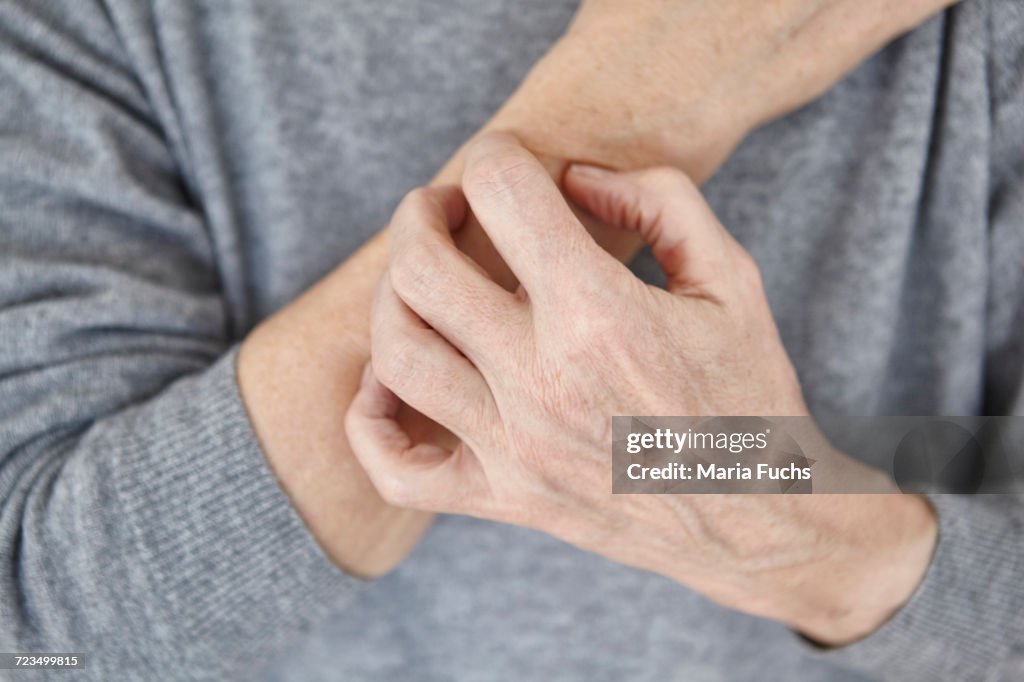 Senior woman scratching arm, close-up