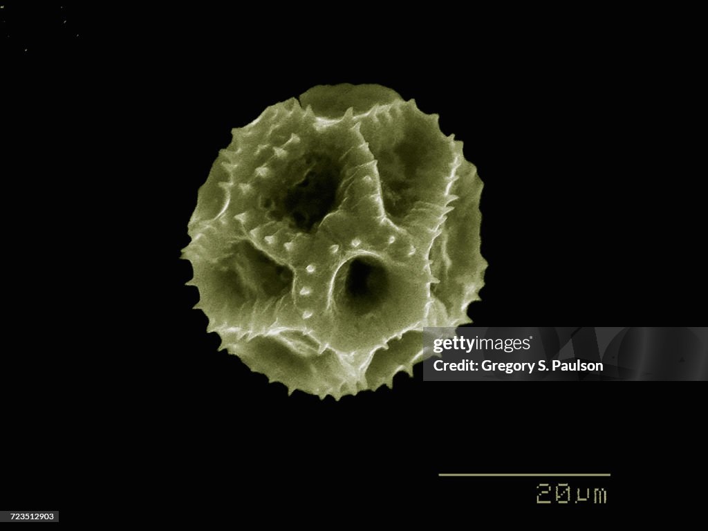 Dandelion pollen imaged in a scanning electron microscope