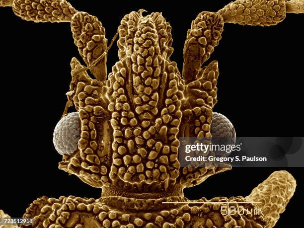 Digital Microscope Insect 586 Electron Microscope Insects Stock Photos, High-Res Pictures, and ...