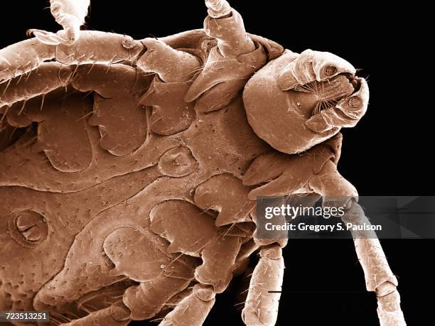 ventral surface of a dog tick (acari: dermacentor sp.) imaged in a scanning electron microscope - scientific micrograph stock-fotos und bilder