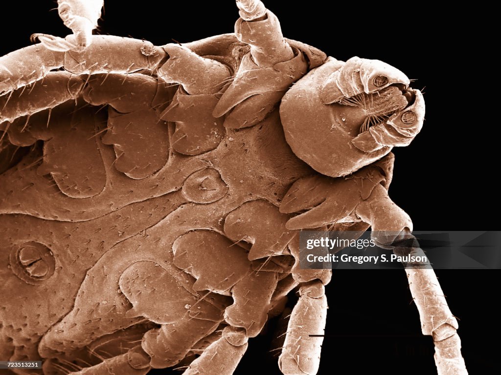 Ventral surface of a dog tick (Acari: Dermacentor sp.) imaged in a scanning electron microscope