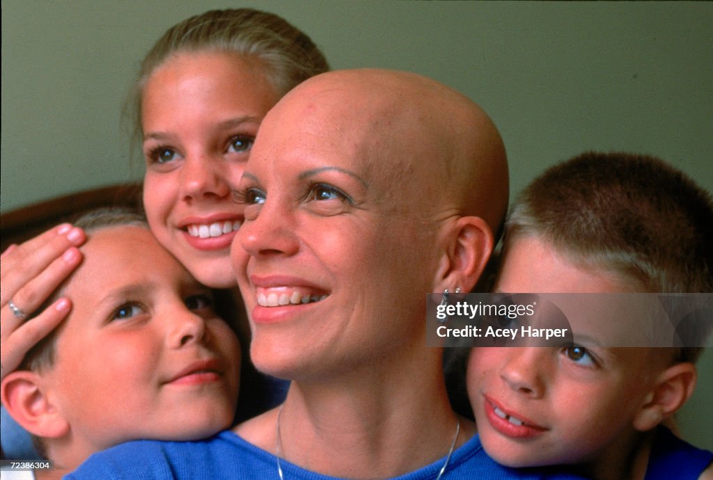 Alopecia sufferer & beauty queen