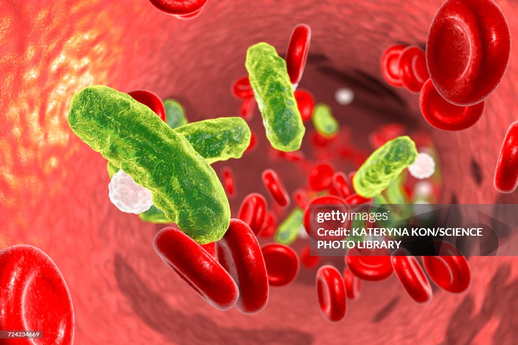 Bacterial blood infection, illustration