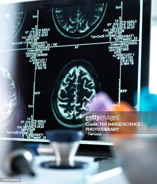 Brain Scan Texture Images Neuroimaging Photos and Premium High Res Pictures - Getty Images