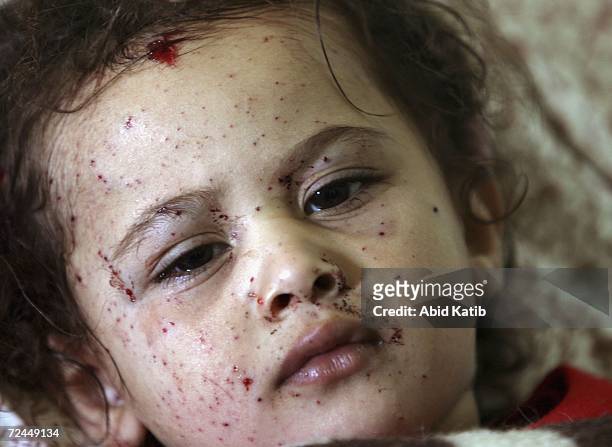 Wounded Palestinian child Malak Al-Athamneh lies at the Kamal Odwan hospital after Israeli tanks fired on homes in Beit Hanoun, November 8, 2006 in...