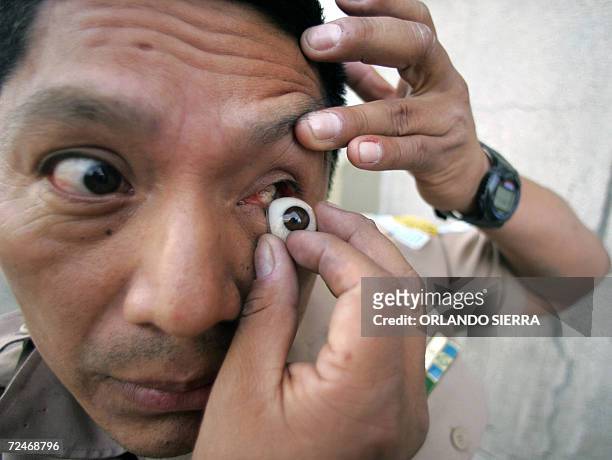 Guatemalan former Captain Alejandro guerra puts a prosthesis on his eye during a hunger strike in Guatemala City 08 November, 2006. Guatemalan Army...