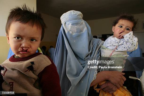 Bageer waits with other Afghan children to be seen at a special clinic to help cleft lip and palate patients at the CURE International hospital in...