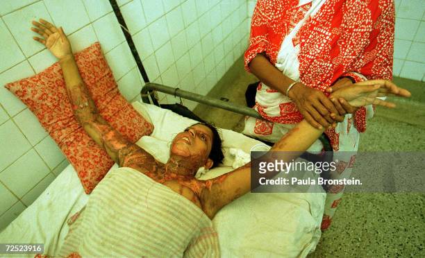 Reba, a 19 year-old Bangladeshi woman, lies with her arms outstretched, July 2000 in Dhaka, Bangladesh as a family member tends to her wounds from a...
