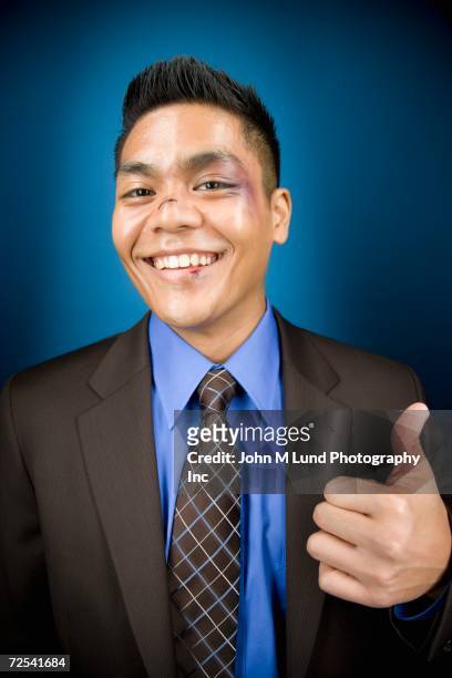 bruised asian businessman smiling and giving thumbs up - black eye stockfoto's en -beelden