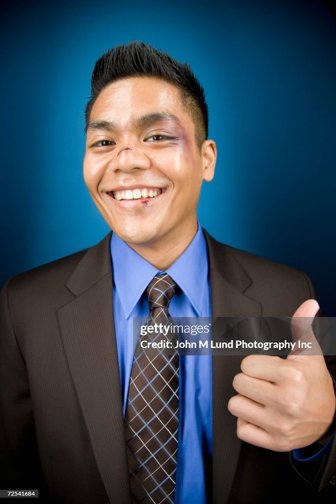 Bruised Asian businessman smiling and giving thumbs up