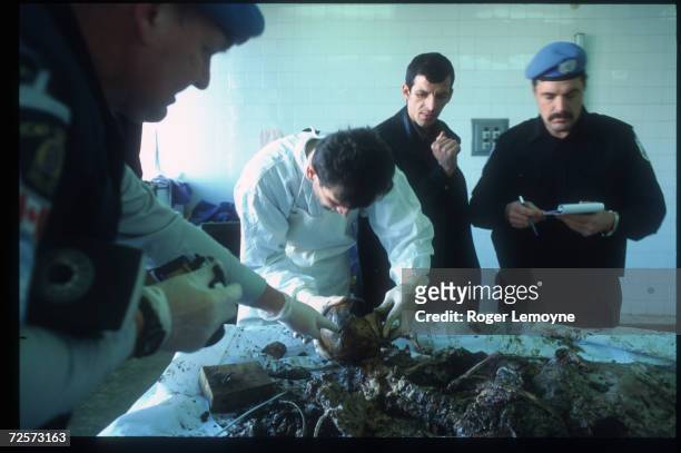 Coroner performs an autopsy at the Pristina Hospital as United Nations officials look on December 15, 1999 in Pristina, Yugoslavia. In March 1999,...