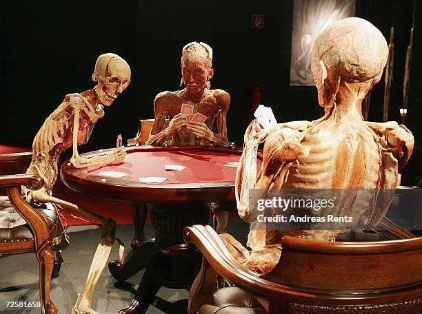 Gunther von Hagens, known as "The Plastinator", shows exhibits in a scene of the current James Bond film Casino Royale at the Plastinarium workshop...