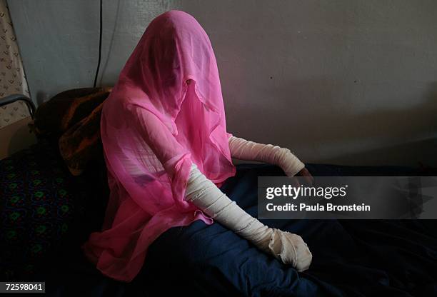 Nazgul a self-immolation victim sits on her hosptial bed covered by her headscarf at the Herat Regional hospital November 17, 2006 in Herat,...