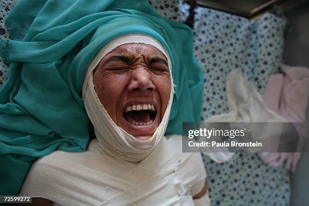 Panwasha screams in pain as her burned skin is cleaned after her successful skin graft operation at the Herat hospital burn unit November 17, 2006 in...