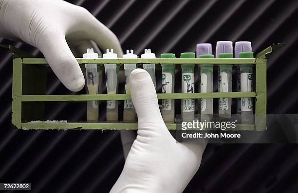 Medical technician handles HIV positive samples during testing at the Pakistan Institute of Medical Sciences, , on April 18, 2006 in Islamabad,...