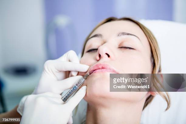 aesthetic surgery, woman receiving derma filler - lip injections stock pictures, royalty-free photos & images