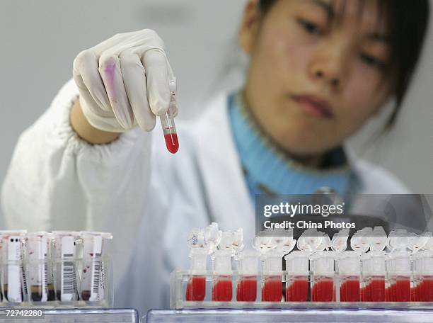 Worker performs a CD4 HIV test at a lab of Shanghai Xuhui District Central Hospital on December 6, 2006 in Shanghai, China. Shanghai's medical...