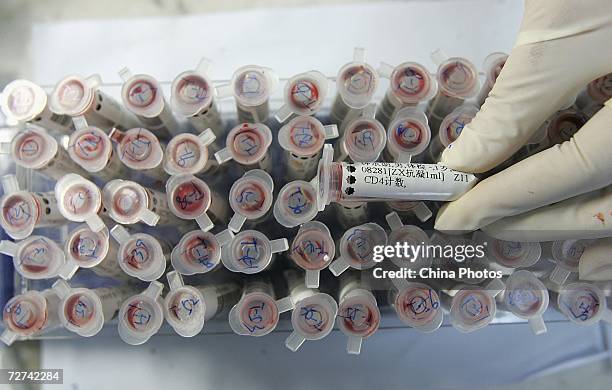 Worker displays samples of CD4 HIV testing at a lab of Shanghai Xuhui District Central Hospital on December 6, 2006 in Shanghai, China. Shanghai's...
