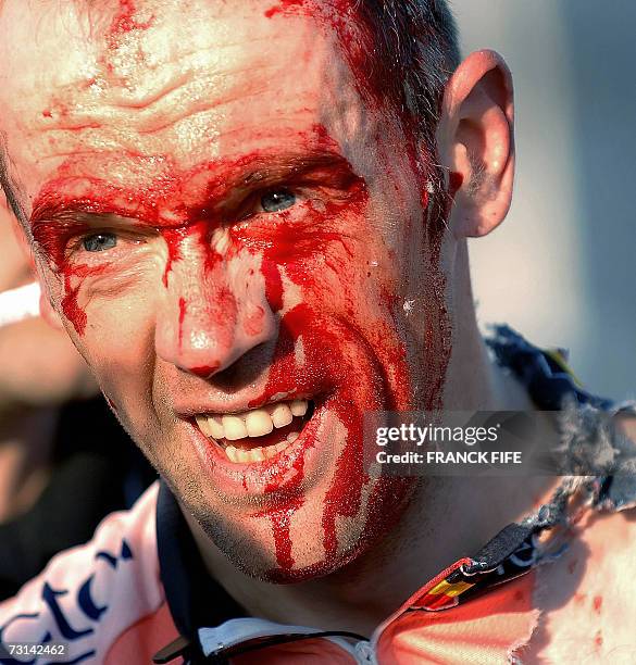 Belgian Tom Steels of Chocolade Jacques team grimaces after falling during the second stage of the 6th edition Tour of Qatar cycling race between...