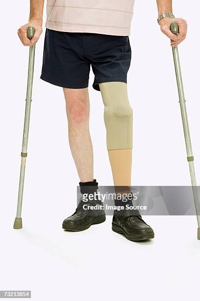 man with an artificial limb - onderste deel stockfoto's en -beelden