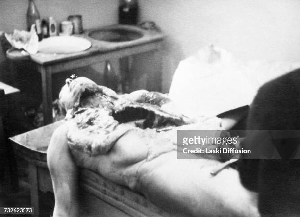 1940s: A post-mortem examination by Nazi physicians of a Polish victim named Nowicki in German-occupied Poland, circa 1942. A photo from an album...
