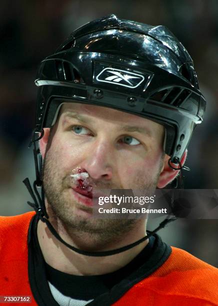 Alexei Zhitnik of the Philadelphia Flyers after being cut in the second period against the Detroit Red Wings at the Wachovia Center February 12, 2007...