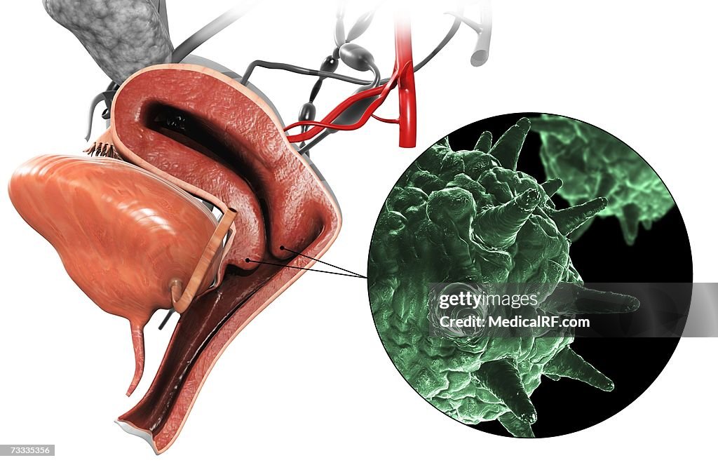 Herpes virus