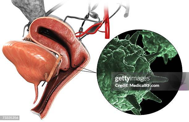 herpes virus - human papilloma virus stock illustrations