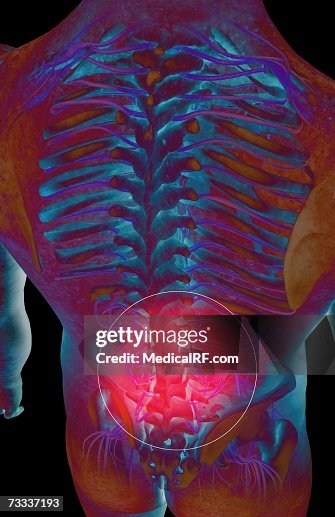 Back pain Back pain