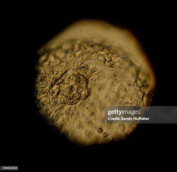 Donated human embryo is seen through a microscope at the La Jolla IVF Clinic February 28, 2007 in La Jolla, California. The clinic accepts donated...