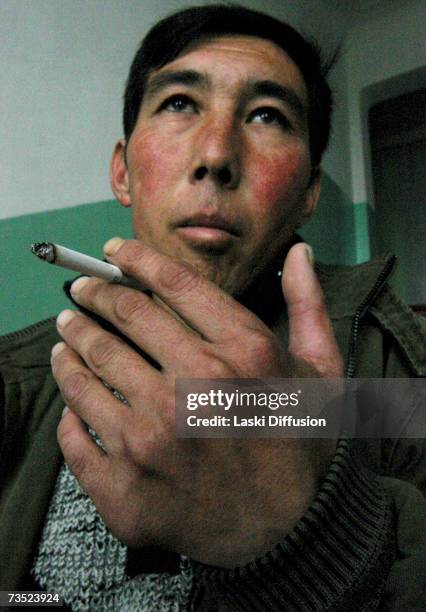 Azamat Kazizov, born not far from Mailuu-Suu, the only of seven siblings with 12 fingers and 12 toes, smokes a cigarette in this photo taken in...