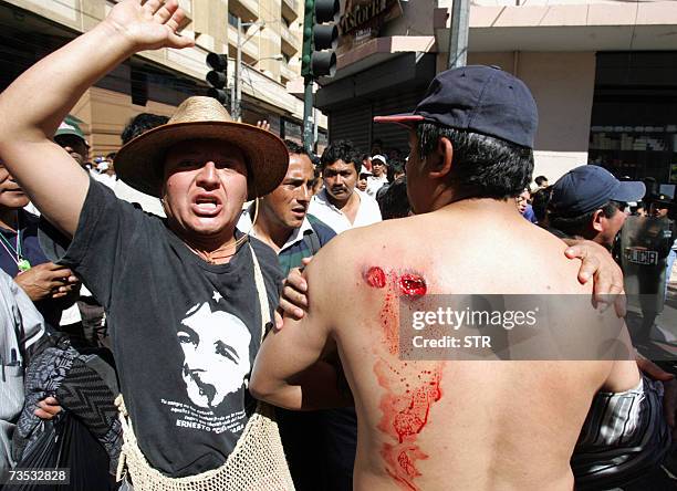 Guatemala City, GUATEMALA: Un miembro de un grupo social muestra las heridas en su espalda tras un enfrentamiento con la Policia Nacional Civil en el...