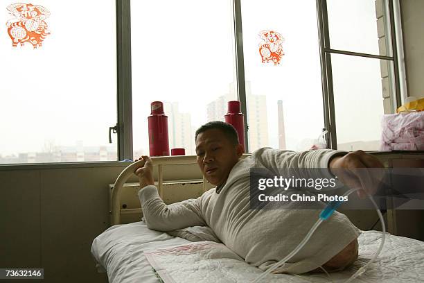 Peng Shuilin, whose body was severed in half in a traffic accident, arranges a catheter to help drain urine at the China Rehabilitation Research...