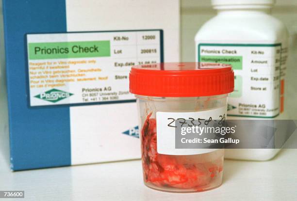Jar containing a cow's brain sample sits on the counter next to a prion testing kit at the Czech State Veterinary Institute, where scientists were...