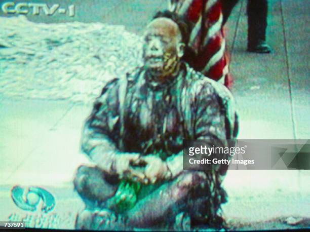 Chinese television footage, described as showing a badly burned Falun Gong member after he set himself on fire January 23, 2001 in Beijing's...