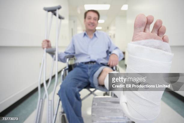 man sitting in wheelchair with broken leg in hospital - pierna fracturada fotografías e imágenes de stock