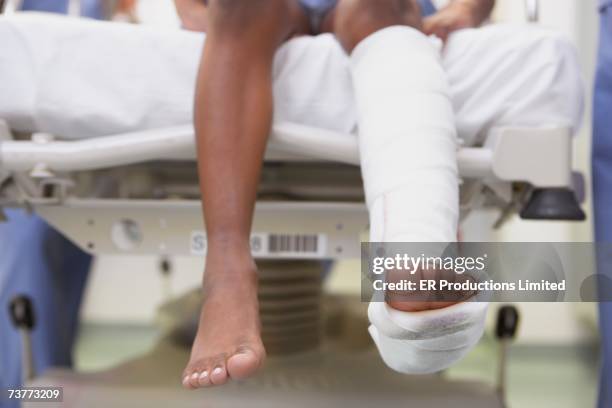 close up of african boy with broken leg in hospital - kind gips stock-fotos und bilder