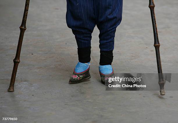 Bound feet woman walks at Liuyi Village on April 2, 2007 in Tonghai County of Yunnan Province, China. Liuyi Village is known as the "Bound Feet Women...